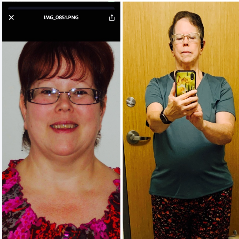 Tammye Hogle's GLP-1 story