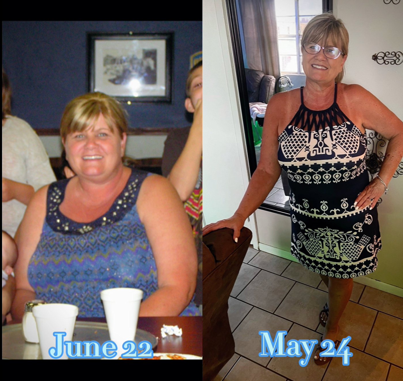 Cheryl Bugge's GLP-1 story